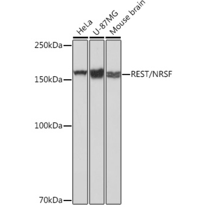 REST/NRSF Rabbit Monoclonal Antibody