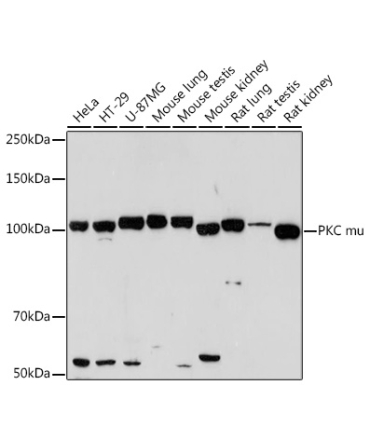 PKC mu Rabbit Monoclonal Antibody