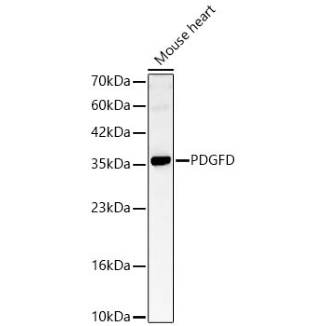 PDGFD Rabbit Polyclonal Antibody