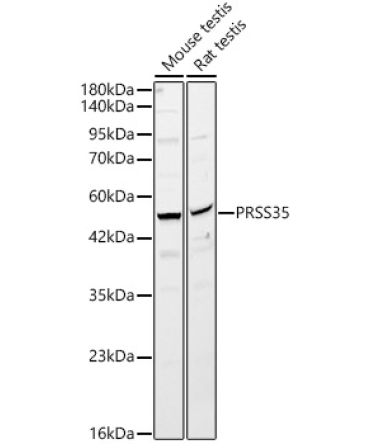 PRSS35 Rabbit Polyclonal Antibody