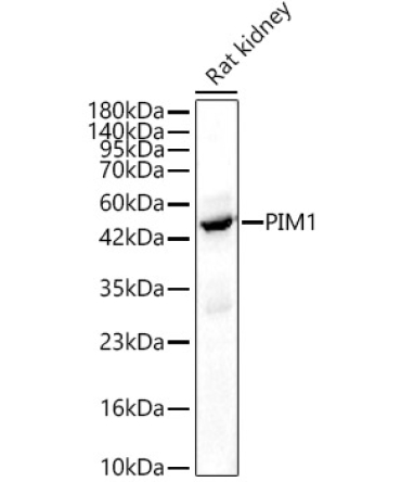 PIM1 Rabbit Polyclonal Antibody