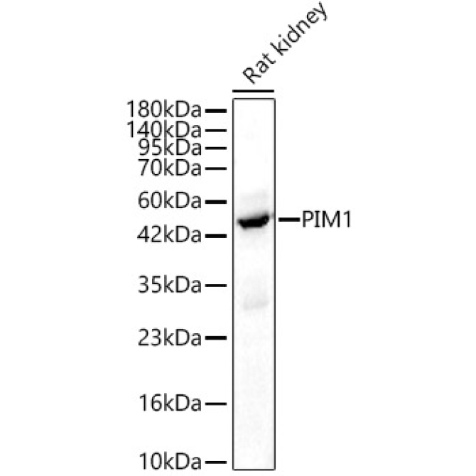 PIM1 Rabbit Polyclonal Antibody