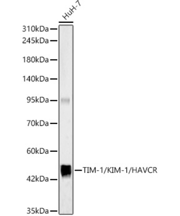 TIM-1/KIM-1/HAVCR Rabbit Polyclonal Antibody