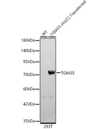 TGM3 Rabbit Polyclonal Antibody