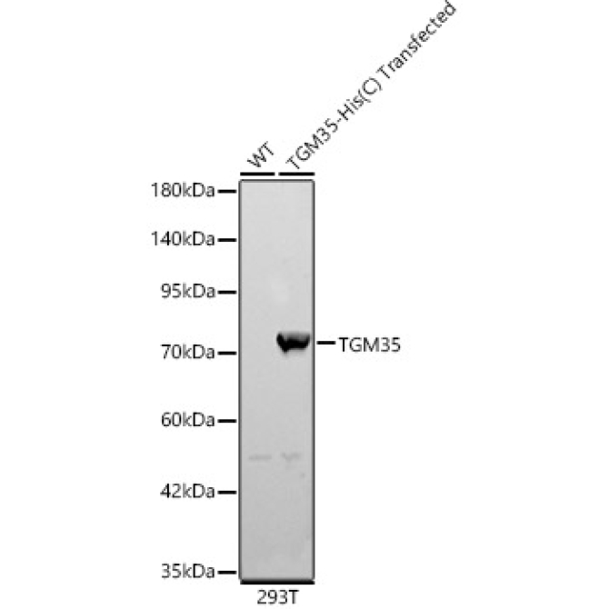 TGM3 Rabbit Polyclonal Antibody