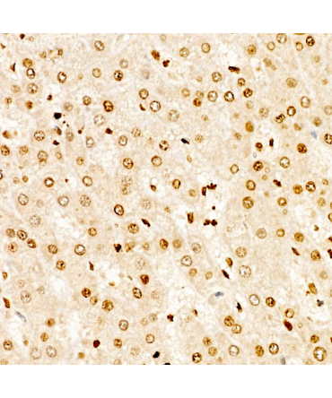 SEC14L2 Rabbit Polyclonal Antibody