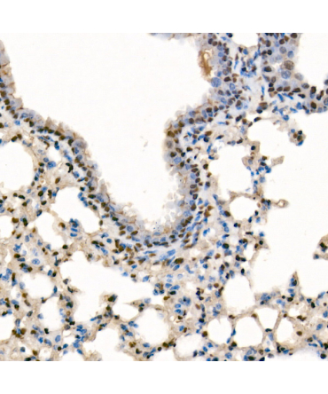 SETD1B Rabbit Polyclonal Antibody