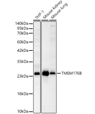 TMEM176B Rabbit Polyclonal Antibody