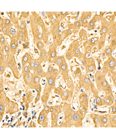 SLC27A6 Rabbit Polyclonal Antibody