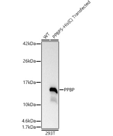 PPBP Rabbit Polyclonal Antibody