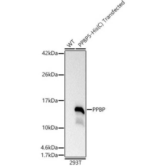 PPBP Rabbit Polyclonal Antibody