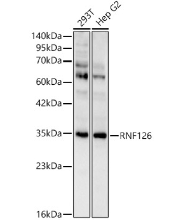RNF126 Rabbit Polyclonal Antibody