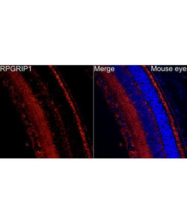 RPGRIP1 Rabbit Polyclonal Antibody