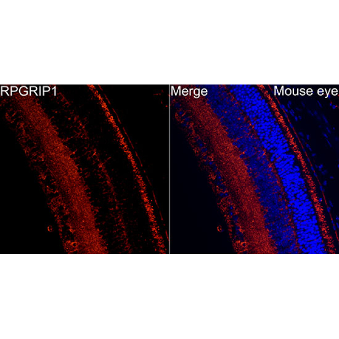 RPGRIP1 Rabbit Polyclonal Antibody