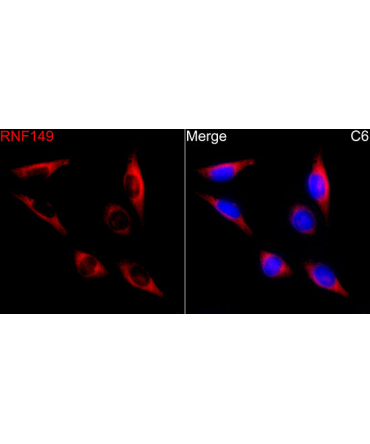 RNF149 Rabbit Polyclonal Antibody