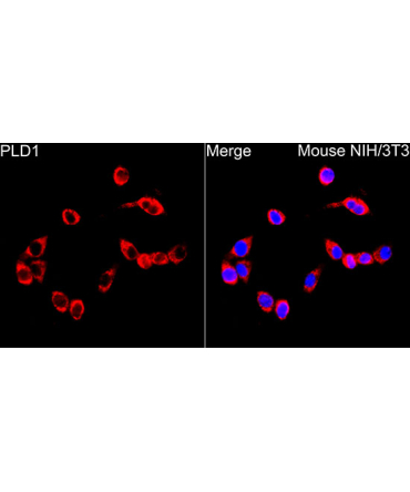 PLD1 Rabbit Polyclonal Antibody