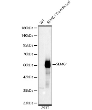 SEMG1 Rabbit Polyclonal Antibody