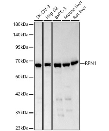 RPN1 Rabbit Polyclonal Antibody