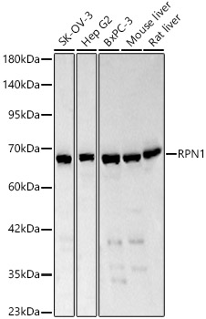 RPN1 Rabbit Polyclonal Antibody