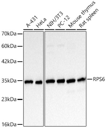 RPS6 Mouse Monoclonal Antibody
