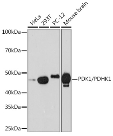 PDK1/PDHK1 Rabbit Monoclonal Antibody