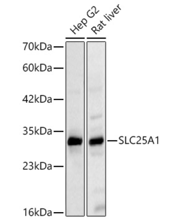 SLC25A1 Rabbit Polyclonal Antibody
