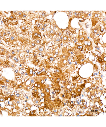 PRELID3A Rabbit Polyclonal Antibody