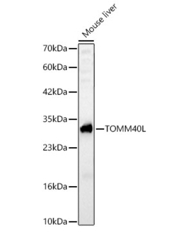 TOMM40L Rabbit Polyclonal Antibody