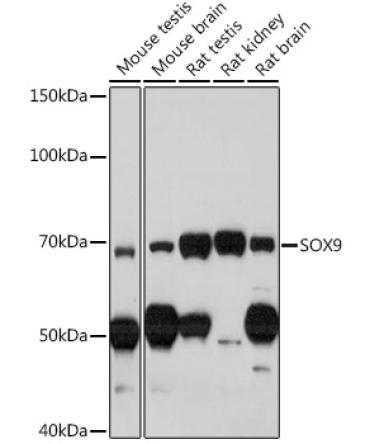 SOX9 Rabbit Polyclonal Antibody