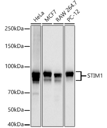 STIM1 Rabbit PolyMonoclonal Antibody?