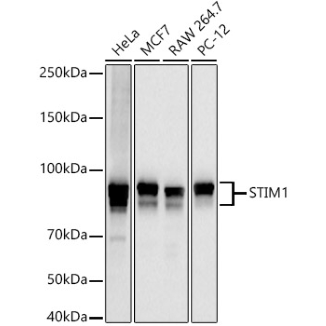 STIM1 Rabbit PolyMonoclonal Antibody?