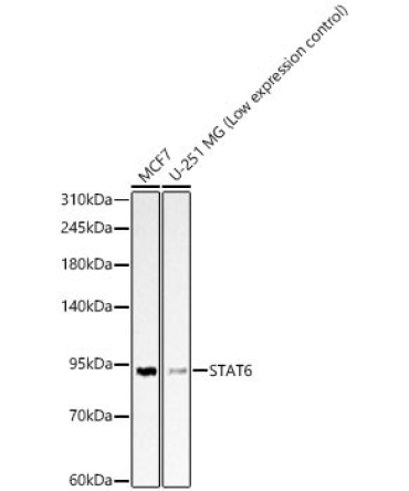 STAT6 Rabbit Polyclonal Antibody