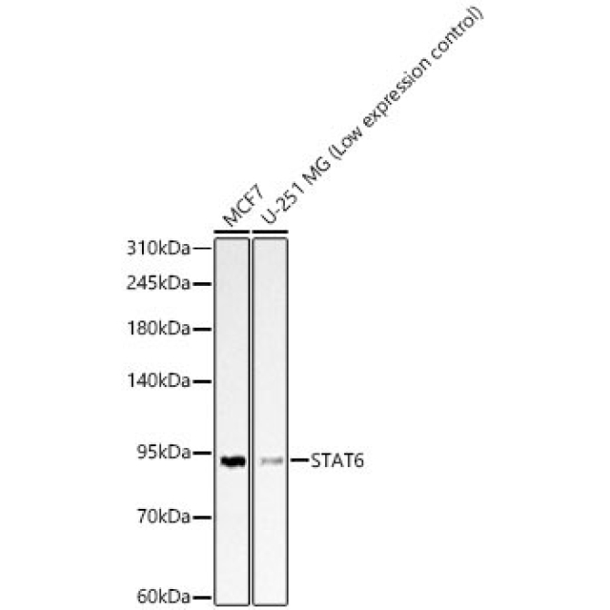 STAT6 Rabbit Polyclonal Antibody