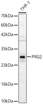 PRG2 Rabbit Polyclonal Antibody