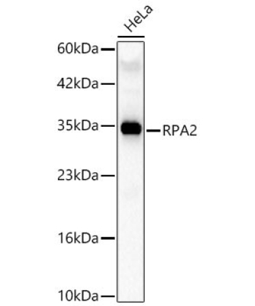 RPA2 Rabbit Polyclonal Antibody