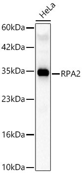 RPA2 Rabbit Polyclonal Antibody