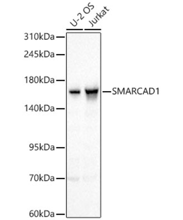 SMARCAD1 Rabbit Polyclonal Antibody