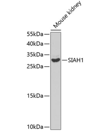 SIAH1 Rabbit Polyclonal Antibody