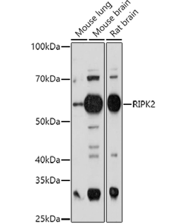 RIPK2 Rabbit Polyclonal Antibody