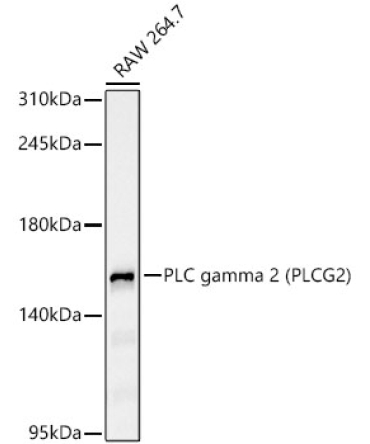 PLC gamma 2 (PLCG2)?Rabbit Monoclonal Antibody