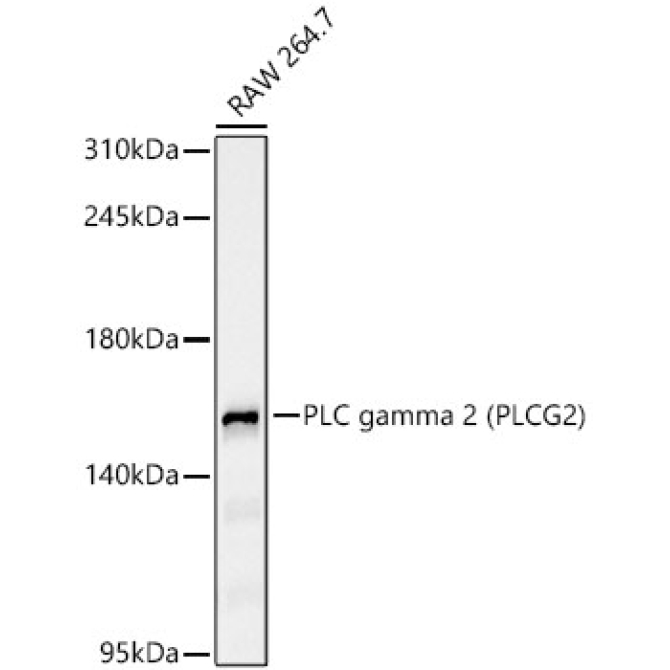 PLC gamma 2 (PLCG2)?Rabbit Monoclonal Antibody
