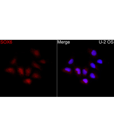 SOX6 Rabbit Polyclonal Antibody