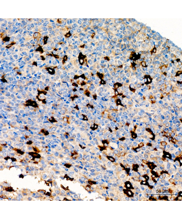 Thyroid Stimulating Hormone (TSH) Rabbit Polyclonal Antibody