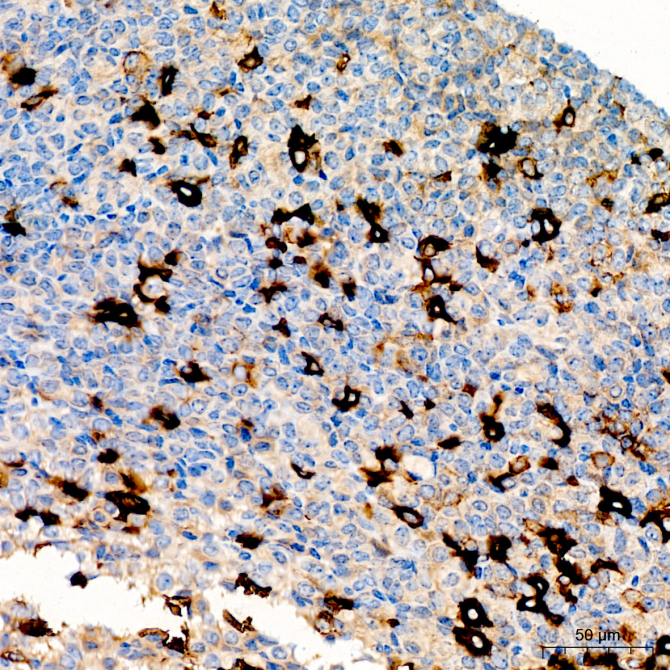 Thyroid Stimulating Hormone (TSH) Rabbit Polyclonal Antibody