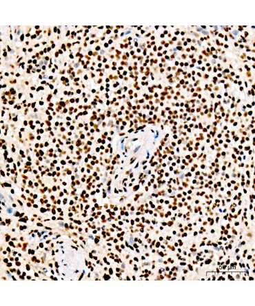 PML Rabbit Polyclonal Antibody