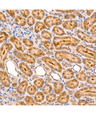 RIP3 Rabbit Polyclonal Antibody
