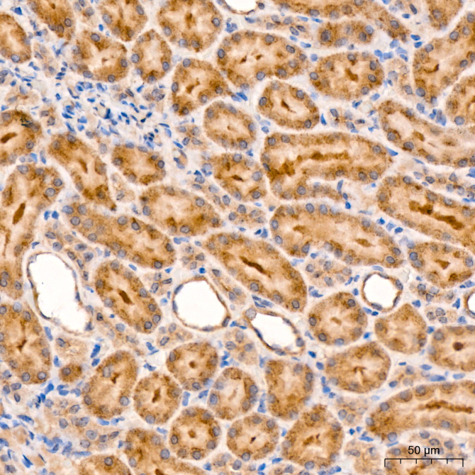 RIP3 Rabbit Polyclonal Antibody