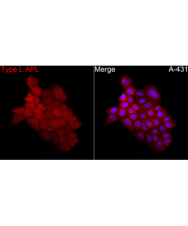 PML+RARA Rabbit Polyclonal Antibody