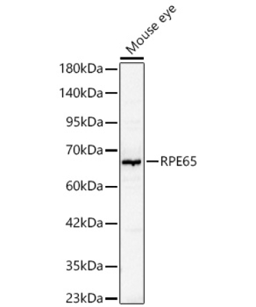 RPE65 Rabbit Polyclonal Antibody