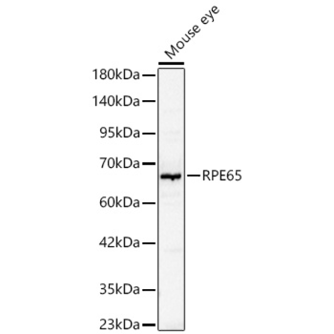 RPE65 Rabbit Polyclonal Antibody